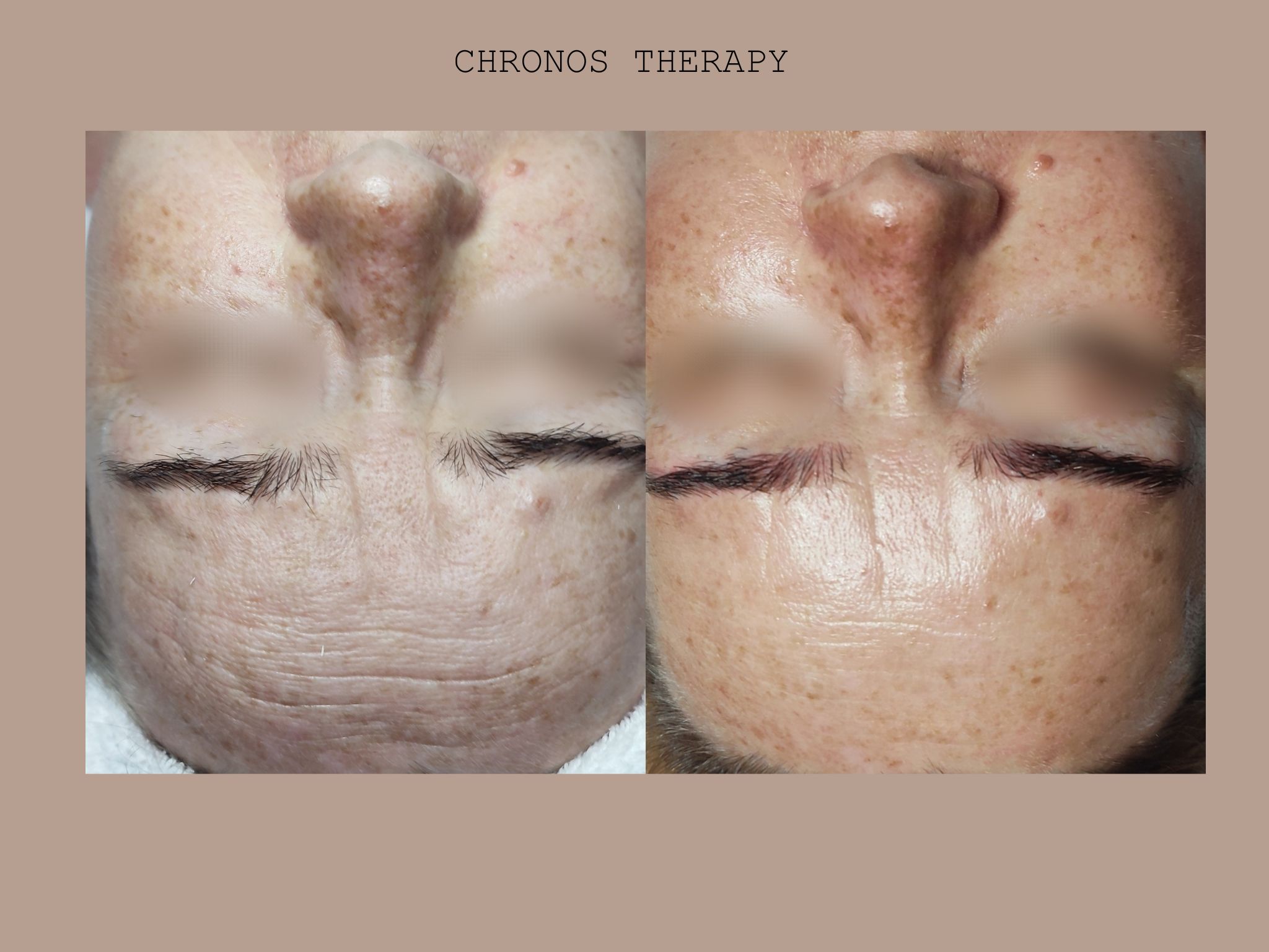 CHRONOS THERAPY(1)